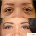 Jerome Alexander CoverAge Eye Concealer - 5-in-1 Anti-Aging Concealer Stick with Eye Roller Ball - Buy Online on GoSupps.com