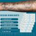 50 Pack Large Shower Waterproof Patch - 6 x 8 Inch Transparent Stretch Adhesive Bandages - Buy Online on GoSupps.com