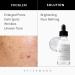 Buy Niacinamide Serum for Face - Anti-Aging Pore Minimizing & Hydrating - 10% Vitamin B3 with Hyaluronic Acid - 29 ml | International Shipping - Buy Online on GoSupps.com