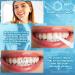 4 Pieces Tooth Gem Set | Rhinestone Tooth Shine Jewelry | DIY Crystal Tooth Ornaments for Reflective Teeth Decor (White - Buy Online on GoSupps.com