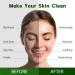 Purederm Vegan Aloe Face Sheet Masks (12 Packs) for Dry, Dehydrated, and Dull Skin - Hydrating, Moisturizing, Brightening, and Soothing Beauty Mask for All Skin Types - Aloe Vera 12 Pack - Buy Online on GoSupps.com