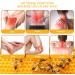 High Strength Bee Venom Cream | Natural Organic Muscle & Joint Pain Relief - Soothe Back Neck Hands & More | International Shipping - Buy Online on GoSupps.com