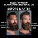 Beard and Bones - 30ml Beard Oil for Men | Natural Carrier Oils of Jojobia Avocado and Castor Oil | Black Skull & Scented Beard Oil | Choice of 6 Scents Savage - Buy Online on GoSupps.com