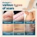 Reusable Silicone Scar Tape Sheets (120 x 1.6 ) - Medical Grade Treatment for Surgical Scars Keloids & Burns - Customizable for Tummy Tucks & C-Sections - Buy Online on GoSupps.com