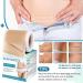 Silicone Scar Sheets Tape (1.6 x 60 Roll) - Professional Scar Removal for Surgical Scars, Keloid, C-Section, Burn, Acne - Brown - Buy Online on GoSupps.com