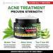 Acne Medication Face Cream - Fast Acting USA-Made Treatment for Stubborn Pimples, Blackheads, Whiteheads - Soothing Moisturizer for Acne Relief & Scar Prevention - 2oz - Buy Online on GoSupps.com