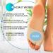 Metatarsal Pads for Bunions & Neuroma Pain Relief - Gel Cushions for Women/Men (Sizes 5-8/5.5-6.5) - Forefoot Foot Pads - Buy Online on GoSupps.com