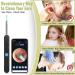 Smart Wireless Ear Wax Removal Tool Camera | Visual Ear Cleaner Kit for Babies, Kids, Adults, Pets | 1296P Ear Otoscope Scope with Cleaning Tool - Buy Online on GoSupps.com