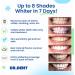 DRDENT Bandes de blanchiment des dents professionnelles 7 traitements Sans danger pour l' mail Blanchiment des dents non sensible Blanchiment sans aucun dommage Lot de 14 bandes + ouvre-bouche - Buy Online on GoSupps.com
