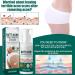 Cr me nettoyante contre l'acn pour les fesses et les cuisses 100 ml de cr me d'acn pour les fesses cr me nettoyante anti-acn cr me anti-boutons sur les fesses limine les boutons et les taches - Buy Online on GoSupps.com