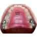 RPE Tongue Guard - Prevents and Heals Tongue Sores from Dental Expanders - Buy Online on GoSupps.com