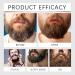 Huile Barbe Homme Huile Barbe Longue Homme Huile De Barbe Pour Homme Naturel Barbe Hydratant & Acc l rateur de Croissance 30 ml (one size vanille) Vanille 30 ml (Lot de 1) - Buy Online on GoSupps.com