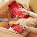 Buy KCLDECI 2L Hot Water Bottle with Red Christmas Tree Cover - Foot Warmer Pain Relief & Hot/Cold Therapy - Buy Online on GoSupps.com