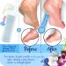 Gladzy Travel Set: Czech Glass Nail File & Callus Remover Foot Rasp - Professional Manicure/Pedicure Kit with Premium EU Quality - Double Sided Etched Grit Surface - Includes Cotton Towel - Pack of - Buy Online on GoSupps.com