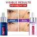 L'Or al Paris LOr al Paris Duo set Day and Night Serum Revitalift Filler 15 Hyaluronic Acid Serum & Revitalift Laser - Buy Online on GoSupps.com