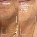 Dr. Brandt Eye Gel & Neck Cream Duo: Say Goodbye to Bags and Sagging Skin - Buy Online on GoSupps.com