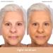 Almay Smart Shade Anti-Aging Foundation with Hyaluronic Acid & Vitamins - Light Medium 1 Fl Oz - Buy Online on GoSupps.com