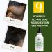 Rosemary & Black Caster Oil Hair Growth Serum | Organic Natural Oils for Breakage & Dry Scalp | Fast Results 2.0 fl oz All Hair Types - Buy Online on GoSupps.com