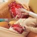 KCLDECI 2L Hot Water Bottle with Cover - Christmas Tree Design for Pain Relief Foot Warmer & Hot/Cold Therapy - Buy Online on GoSupps.com