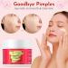 Acne Face Cream with Salicylic Acid | Cystic Acne Treatment for Face & Body | Anti-Acne Skincare for Teens & Adults | 3.53 OZ - Buy Online on GoSupps.com