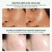 Aloe Vera Gel Moisturising Cream for Face Body Pimples Dry Skin After Sun Sunburn Hair Gel After Sun - Buy Online on GoSupps.com