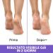 Podovis C/Talloni Screpolati 75 ml - Healing Cream for Cracked Heels | International Shipping Available - Buy Online on GoSupps.com
