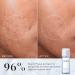 Medik8 Press & Clear - Exfoliating 2% BHA Clarifying Toner - Salicylic & Tranexamic Acid - Reduces Blemishes Blackheads & Oiliness - 150ml - Buy Online on GoSupps.com