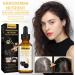  smashing smashing Reverse Grey Hair Biotin Hair Growth Moisturizing Oil with Natural Extract - 30ml Hair Growth Oil Stops Thinning and Hair Loss Suitable - Buy Online on GoSupps.com