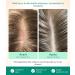 Scalp Oil - 30 ml - S rum pour cuir chevelu sec et irrit ingredients naturels et extrait de neem 30ml - Buy Online on GoSupps.com