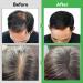  Bibonse Rosemary shampoo with rosemary oil for hair growth vegan rosemary oil against hair loss stimulates hair growth anti-hair loss shampoo - Buy Online on GoSupps.com