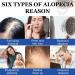 Pegciz Scalp Serum Revitalizer with Argan Oil, Biotin, Caffeine, Stem Cell, Catalase & DHT Blockers - For All Hair Types, Men & Women - Buy Online on GoSupps.com