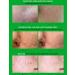 Buy DD ell Micellar Cleansing Water - AHA BHA PHA & Cica Tea Tree Extract - Facial Cleanser & Makeup Remover for All Skin Types - 5.29 fl. oz - Cruelty-Free Alcohol-Free Paraben-Free - Buy Online on GoSupps.com
