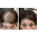 Dark Brown Hair Loss Concealer Trial Size - Cover Bald Spots Instantly - 10-Day Supply - All-Natural Fiber Formula - Buy Online on GoSupps.com