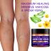 PAULINRISE Varicose Veins Cream - Natural Treatment for Pain Relief - Buy Online on GoSupps.com