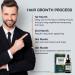 Minoxidil & Biotin Hair Growth Oil for Beards - Prevent Hair Thinning | 5% Minoxidil 1 Fl Oz - For Men & Women - Buy Online on GoSupps.com