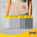 Uriel Abdominal Ostomy Belt XL for Post-Operative Care - Colostomy Ileostomy Surgery Support - Buy Online on GoSupps.com