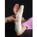 Professional Custom Fiberglass Splint for Wrist & Thumb Injuries | Fast International Shipping - Buy Online on GoSupps.com