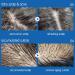 Itchy Scalp Spray Hair Moisturizing Spray Dry Scalp Treat With Nozzle Design To Adjust Water And Oil Balance Suitable For Most Kinds Of Hair Including Oil Hair - Buy Online on GoSupps.com