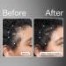 Act+Acre Apple Stem Cell Scalp Serum - Promotes Growth, Lessens Hair Loss, Soothes & Hydrates - Sulphate & Paraben Free - With Aloe Vera - Buy Online on GoSupps.com