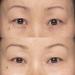 Instant Eye Lift 0.27 oz | Enhance Your Look | Fast International Shipping - Buy Online on GoSupps.com