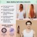 Moerie Mineral Shampoo and Conditioner + Hair Growth Spray Set - Ultimate Hair Care Pack for Longer, Thicker, Fuller Hair | Volumizing, Paraben & Silicone Free - 3 Products - Buy Online on GoSupps.com