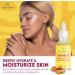 Organic Turmeric Body Oil 1 fl oz / 30 ml | Skin Brightening Essential Oil | Non-Greasy & Ultra-Hydrating Serum | Fights Acne & Evens Tone - Buy Online on GoSupps.com