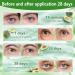 60 Patchs yeux l'avocat Patch Yeux Anti Cernes Masques Hydratants au Gel d Acide Hyaluronique Anti-Cernes et Anti-Rides Soin Nourrissant pour le Contour des Yeux Soins Visage Homme Femme - Buy Online on GoSupps.com