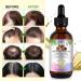 Hair Growth Oil Rosemary Oil for Hair Growth Batana Oil Castor Oil Argan Oil and Coconut Oil Mixed Hair Oil Hair Serum Helps to Hair Growth Prevent Hair Loss and Moisturise Dry Split Ends -60ml - Buy Online on GoSupps.com