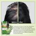 100% Pure Natural Rosemary Oil - Multipurpose Hair Oil for Growth Nourishing Scalp & Strengthening Hair - Buy Online on GoSupps.com