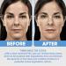 Organic Retinol Cream with Hyaluronic Acid - Anti Aging Moisturizer for Wrinkles & Fine Lines - Buy Online on GoSupps.com
