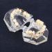 Dental Teeth Model with Metal Brackets - Orthodontic PVC Resin for Dental Schools - Buy Online on GoSupps.com