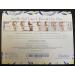 Facial Smoothies Wide Triangle Wrinkle Removal Strips - 144 Anti-Wrinkle Patches for Youthful Skin - Buy Online on GoSupps.com