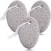 3pcs Natural Pumice Stone for Feet and Hands - Foot Scrubber for Dead Hard Skin - Avos Deals Global - Buy Online on GoSupps.com