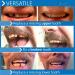 Instant Smile Temporary Tooth Kit - Pro-Series: Transform Your Smile Instantly - Buy Online on GoSupps.com